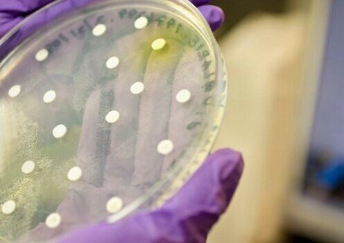 bakteriálna kultúra na diagnostiku prostatitídy